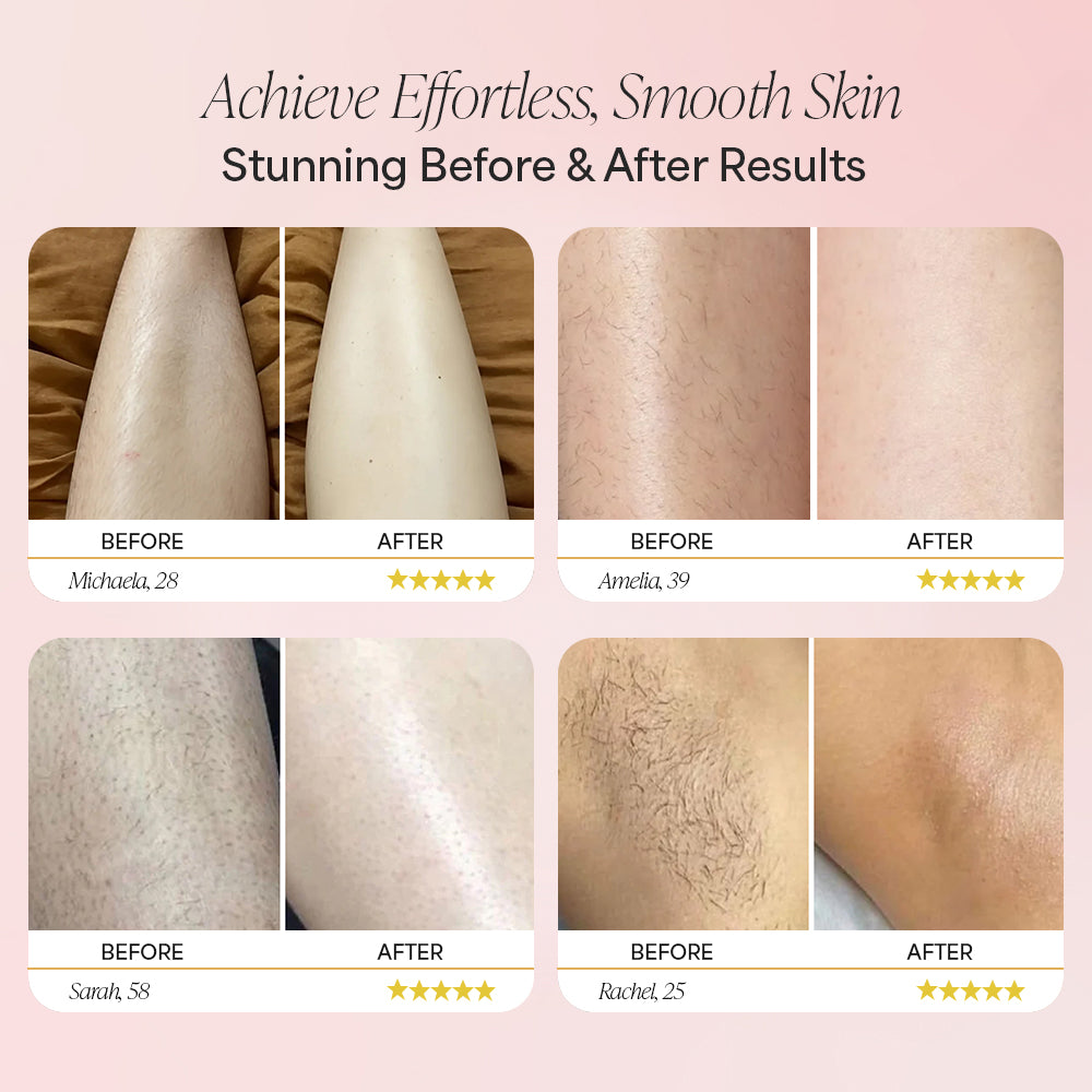 Modern handheld beauty device with indicator lights and a 30-day guarantee badge.