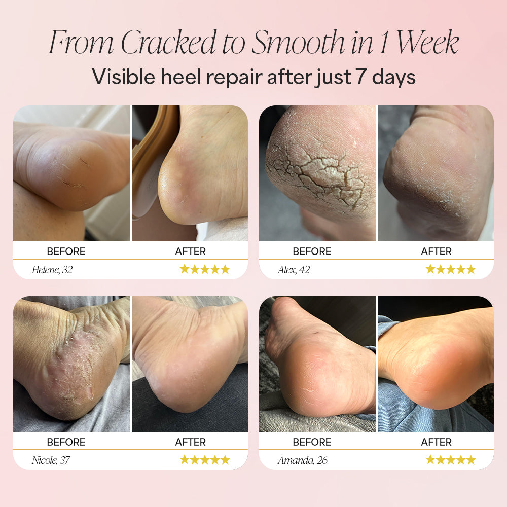 Dermave™ Anti-Crack Foot Cream