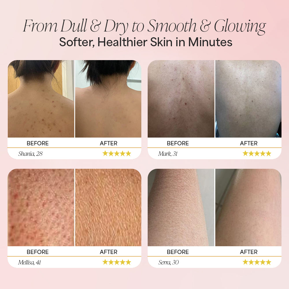 Pink callus remover device with 60 sandpaper disks and 30-day money-back guarantee badge.