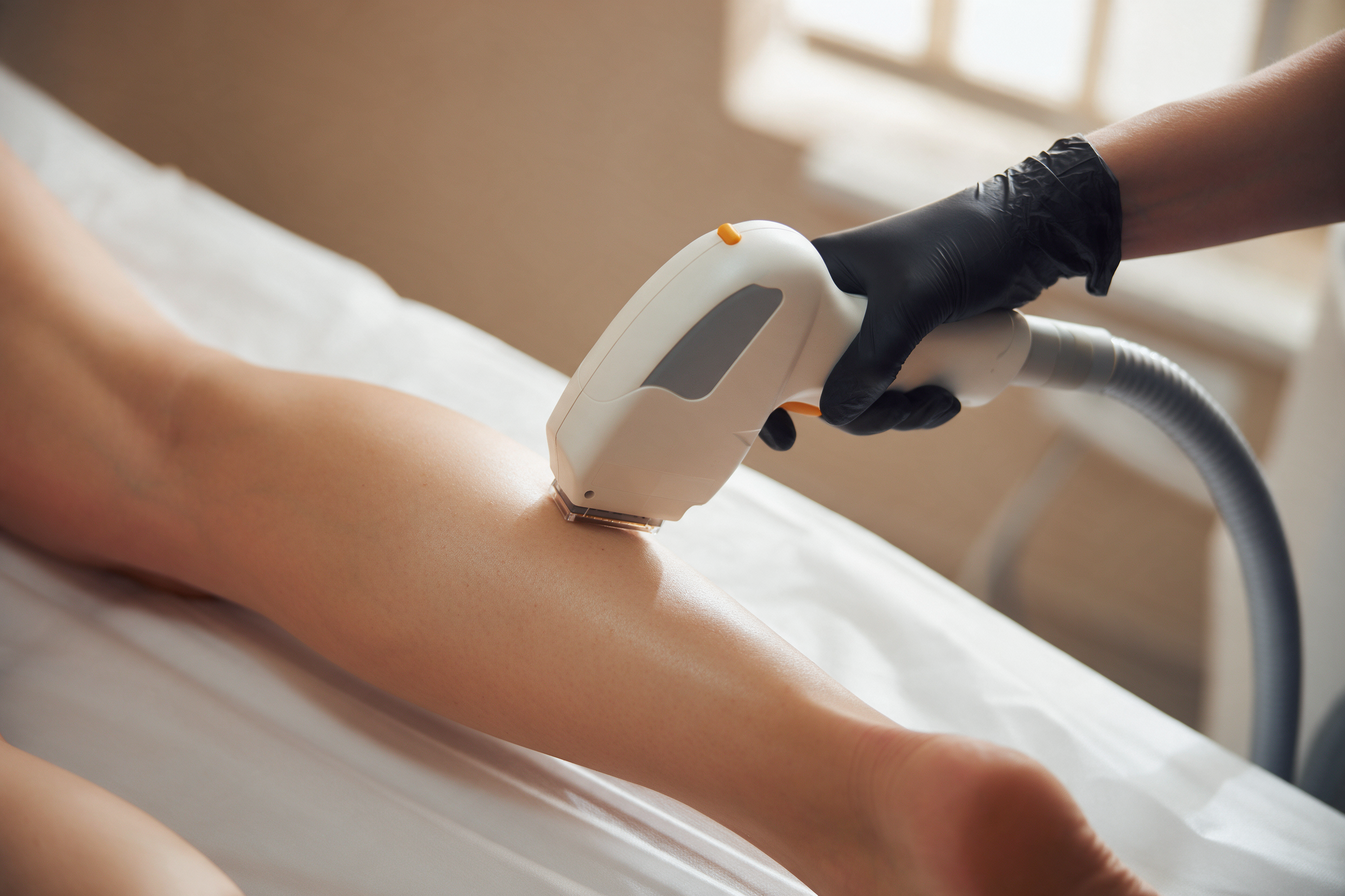 Illustration of a professional laser handpiece treating a lower leg.