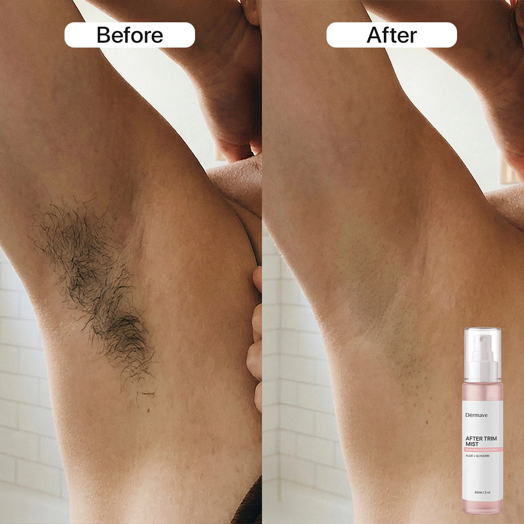 Dermave™ Post-Trim Essentials
