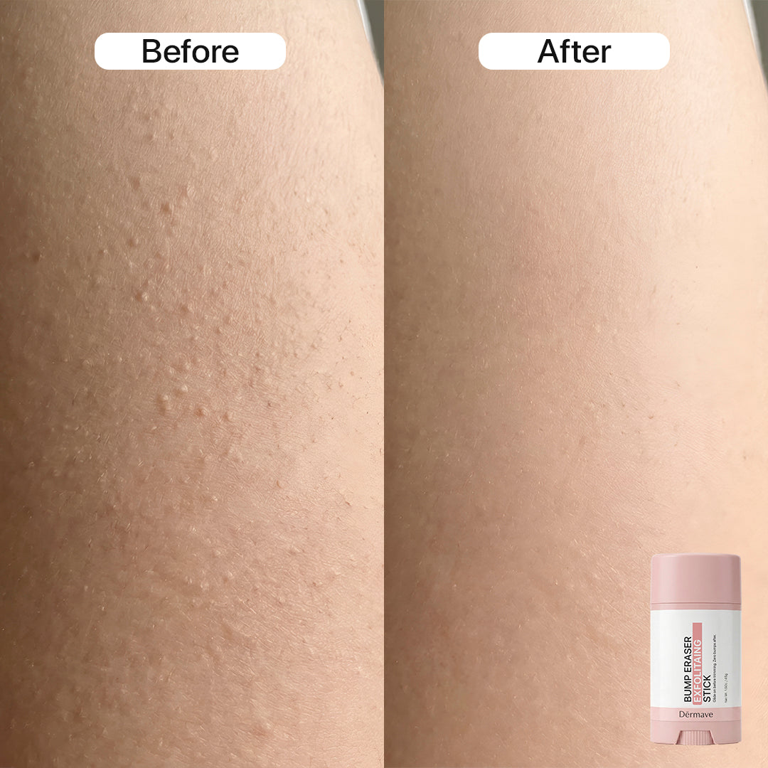 Dermave™ Post-Trim Essentials