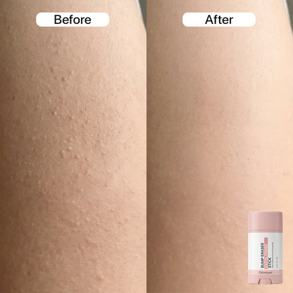 Dermave™ Post-Trim Essentials
