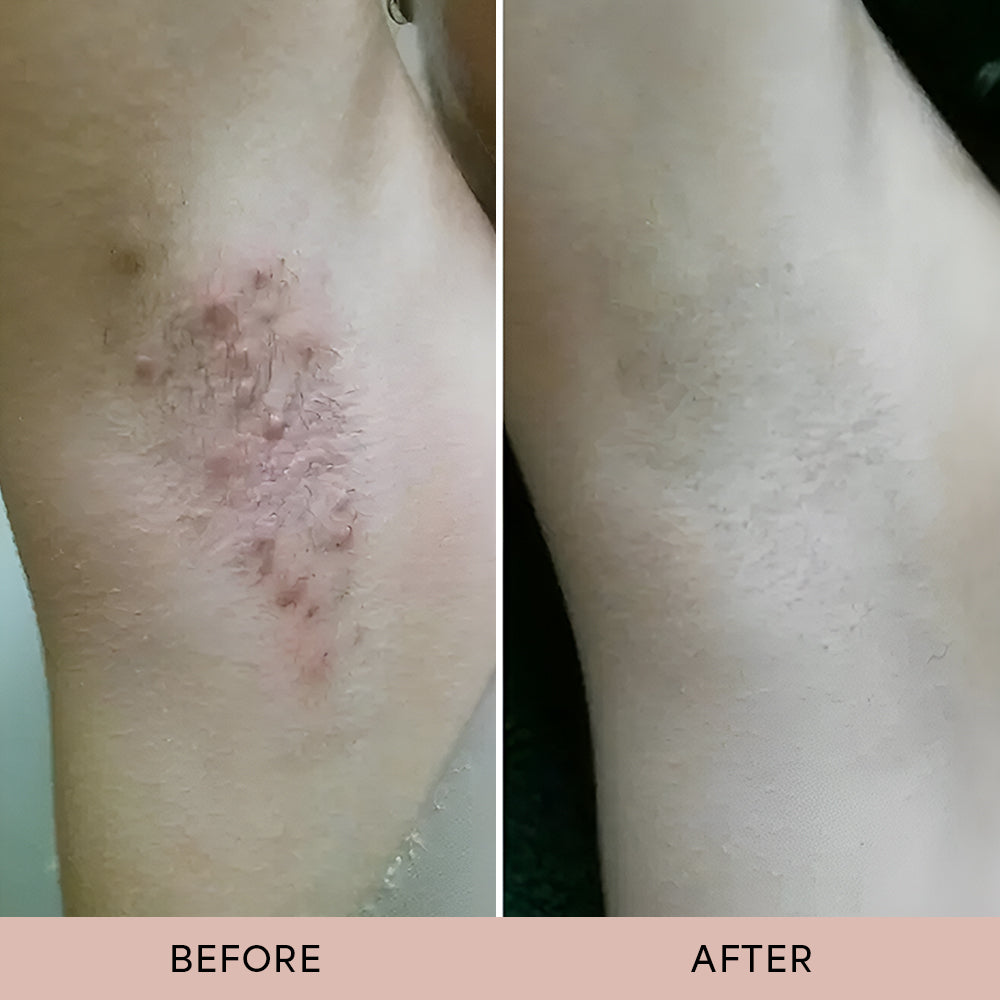 Dermave™ After Trim Oil