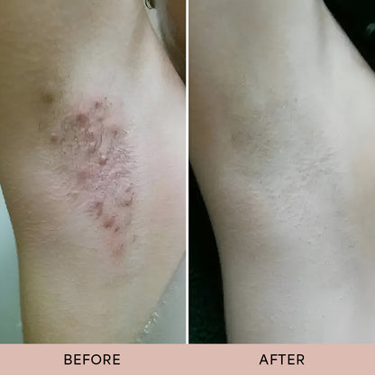 Dermave™ After Trim Oil