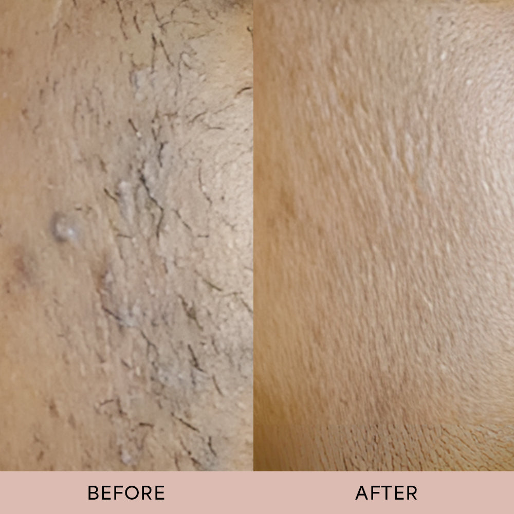 Dermave™ After Trim Oil