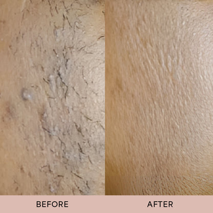 Dermave™ After Trim Oil