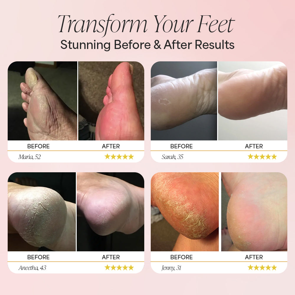 Pink callus remover device with 60 sandpaper disks and 30-day money-back guarantee badge.
